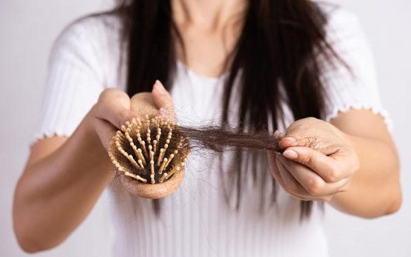 4 thói quen lành mạnh giúp giảm rụng tóc